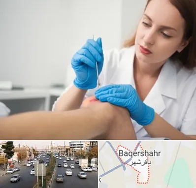 متخصص زخم در باقرشهر