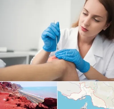 متخصص زخم در هرمزگان