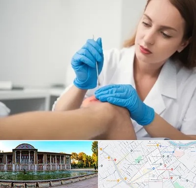 متخصص زخم در عفیف آباد شیراز 