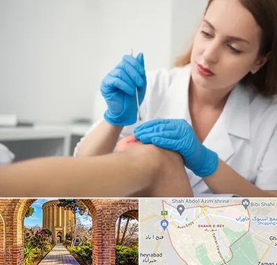 متخصص زخم در شهر ری