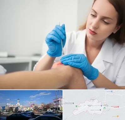 متخصص زخم در ماهدشت کرج 