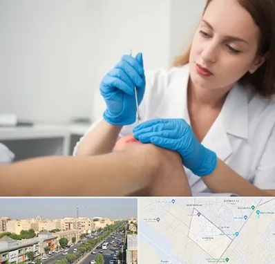 متخصص زخم در کیانمهر کرج 