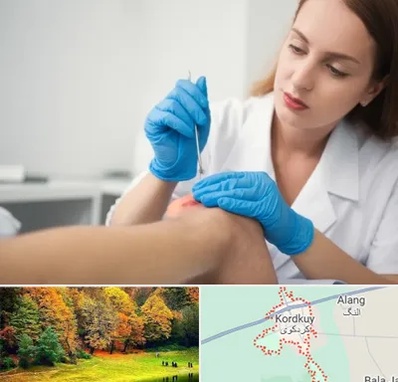 متخصص زخم در کردکوی