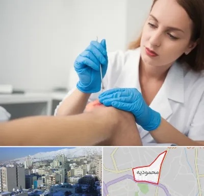 متخصص زخم در محمودیه