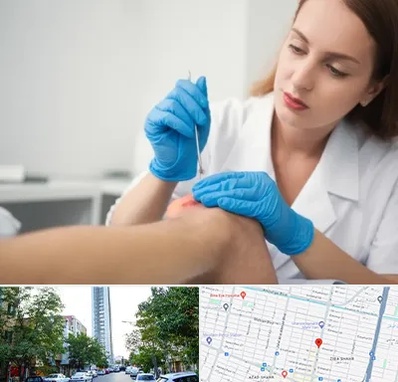 متخصص زخم در امامت مشهد 