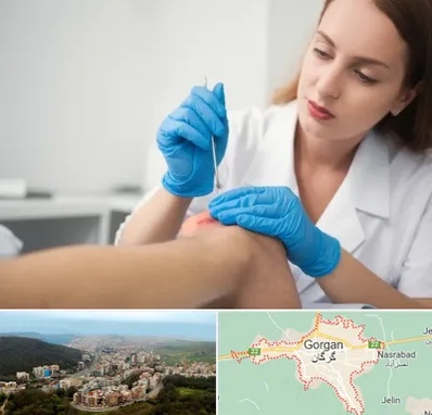 متخصص زخم در گرگان