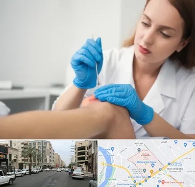 متخصص زخم در زیتون کارمندی اهواز 