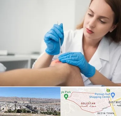 متخصص زخم در شهرک گلستان شیراز 