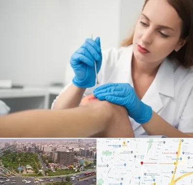 متخصص زخم در آیت الله کاشانی