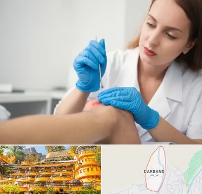 متخصص زخم در دربند 