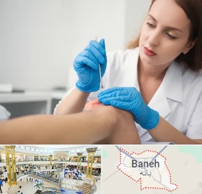متخصص زخم در بانه
