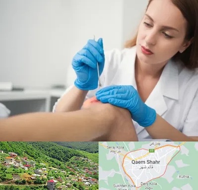 متخصص زخم در قائم شهر