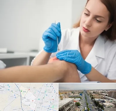 متخصص زخم در حصارک کرج 