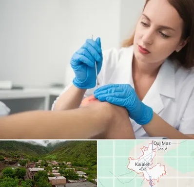 متخصص زخم در کلاله
