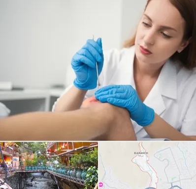 متخصص زخم در درکه 