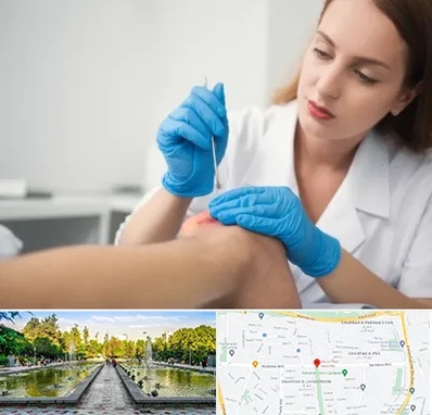 متخصص زخم در سرسبز 