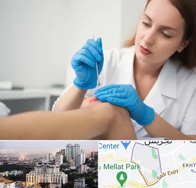 متخصص زخم در الهیه 