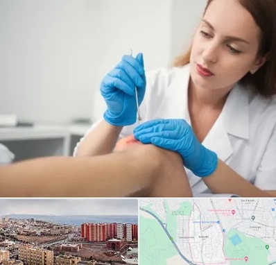 متخصص زخم در سهند تبریز 