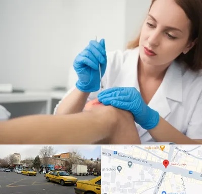 متخصص زخم در شهناز تبریز 