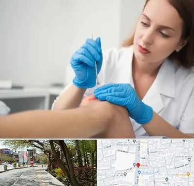 متخصص زخم در خیابان توحید اصفهان 