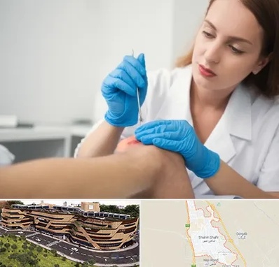 متخصص زخم در شاهین شهر