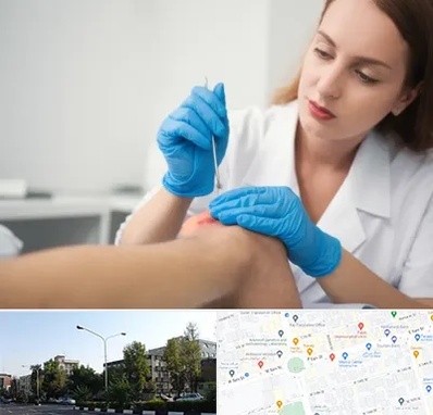 متخصص زخم در میدان کاج 