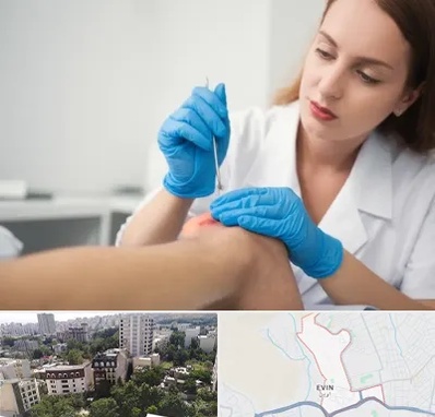 متخصص زخم در اوین 