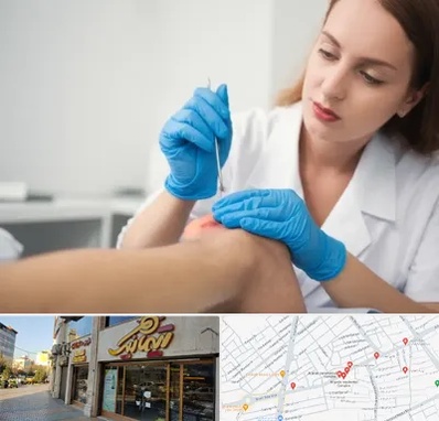 متخصص زخم در عطاران قم 