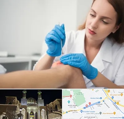 متخصص زخم در زرگری شیراز 