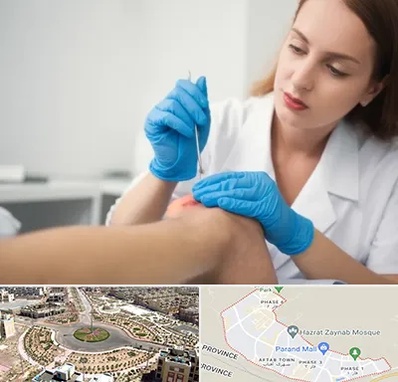 متخصص زخم در پرند