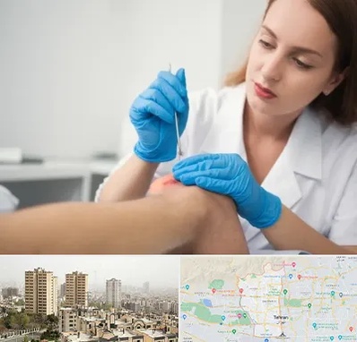 متخصص زخم در منطقه 5 تهران