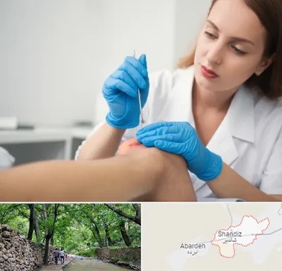 متخصص زخم در شاندیز مشهد 
