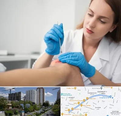 متخصص زخم در اندرزگو 