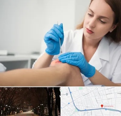 متخصص زخم در ابوریحان تبریز 