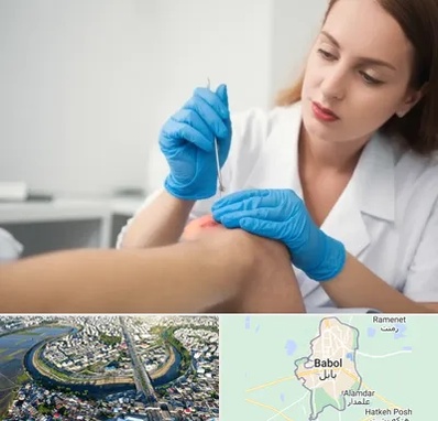 متخصص زخم در بابل