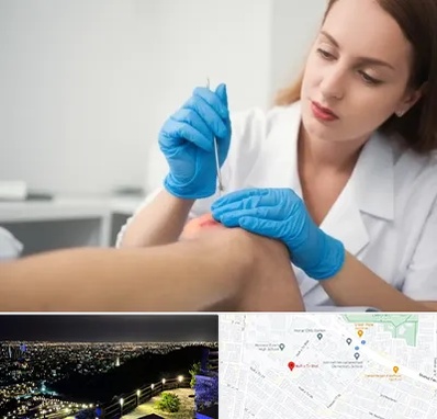 متخصص زخم در هفت تیر مشهد 