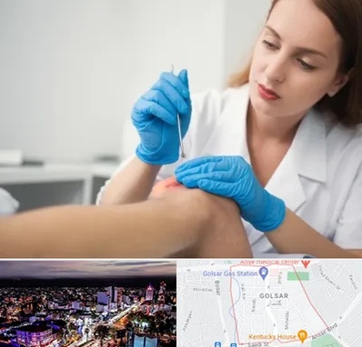 متخصص زخم در گلسار رشت 