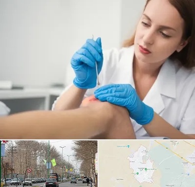 متخصص زخم در نظرآباد کرج 