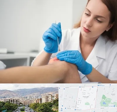 متخصص زخم در خانی آباد 