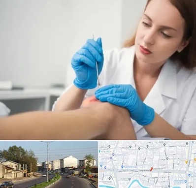 متخصص زخم در ضیابری رشت 