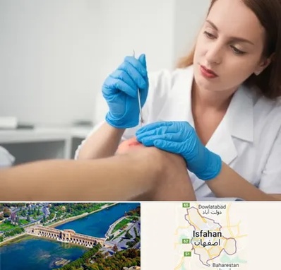 متخصص زخم در اصفهان