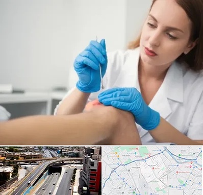 متخصص زخم در ستارخان شیراز 