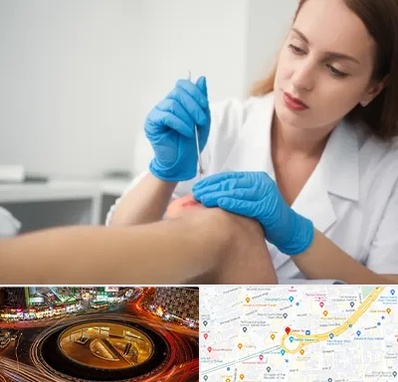 متخصص زخم در میدان ولیعصر 