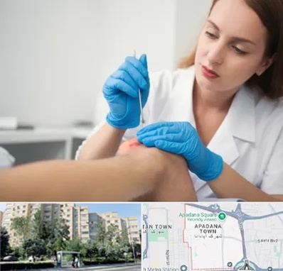 متخصص زخم در آپادانا
