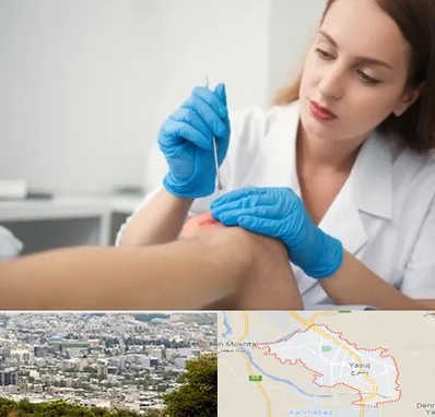 متخصص زخم در یاسوج