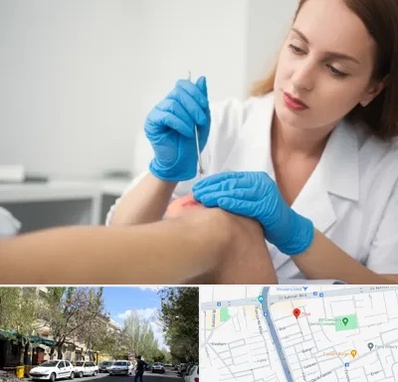 متخصص زخم در کوی فیروز تبریز 