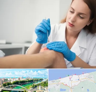 متخصص زخم در بابلسر