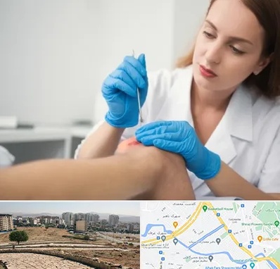 متخصص زخم در کوی وحدت شیراز 