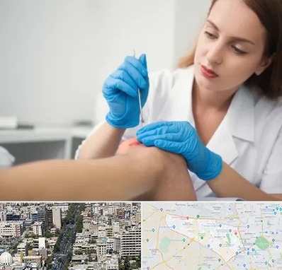 متخصص زخم در منطقه 18 تهران