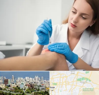 متخصص زخم در شرق تهران 